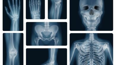 ไต้หวัน มือถือ ช่องคลอด X-Ray