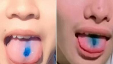 วัยรุ่นลิ้นฟ้า