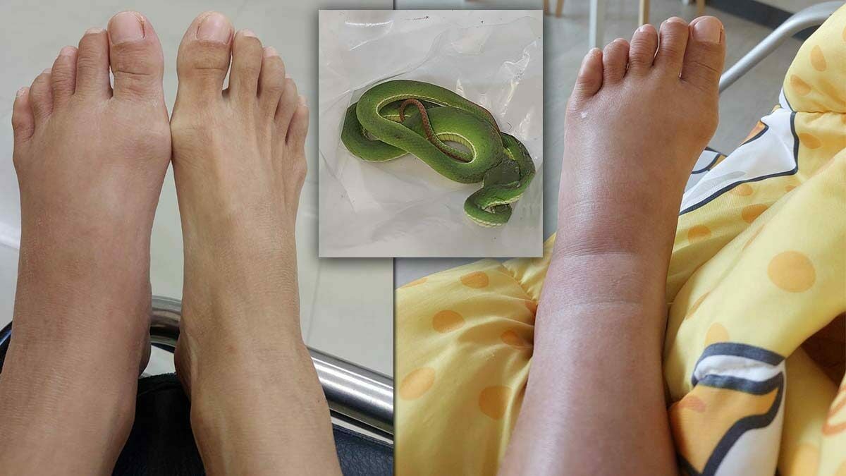 สาวโดนงูฉกในห้าง