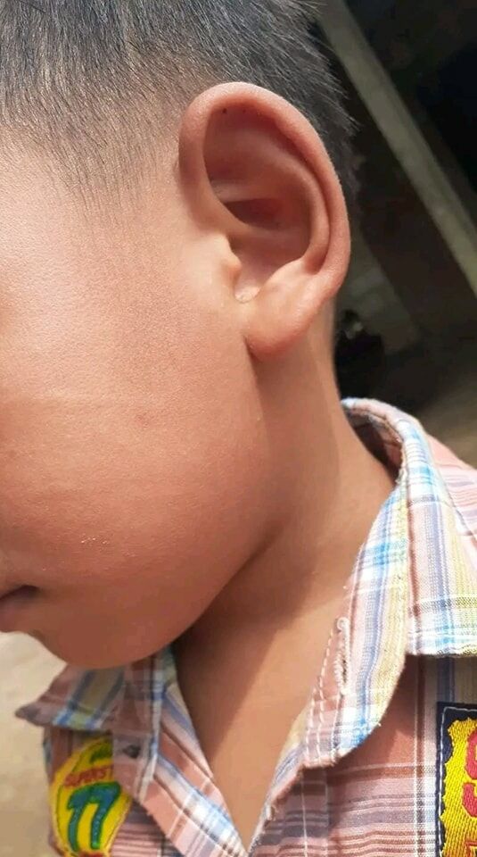 หมอตบหน้าเด็ก