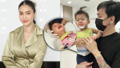 ชมพู่ น้องวายุคางแตก
