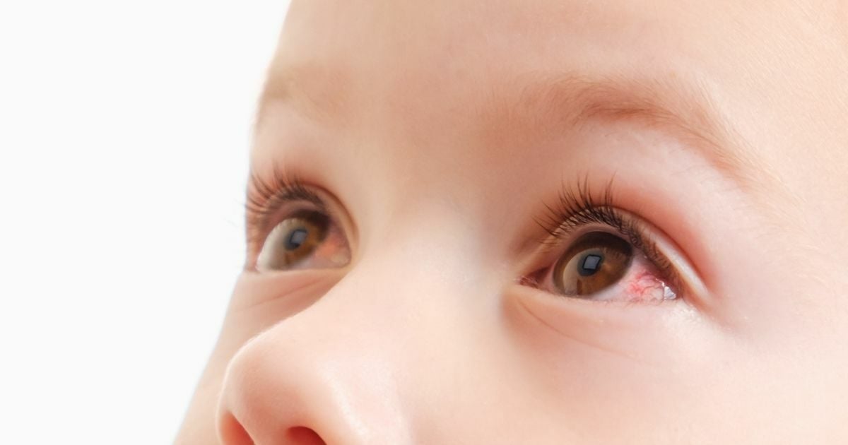 โรคที่มากับหน้าฝน