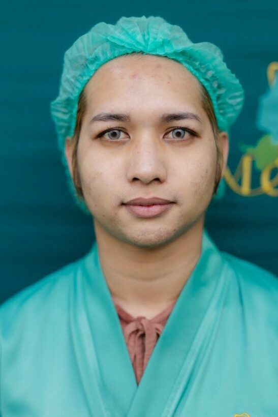 ยกหางตา ก่อนทำ