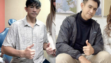 โดโด้ ยุทธพิชัย ศัลยกรรม