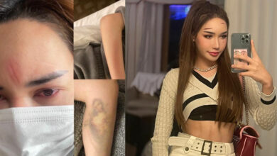 บาสตี้ อิแทวอน