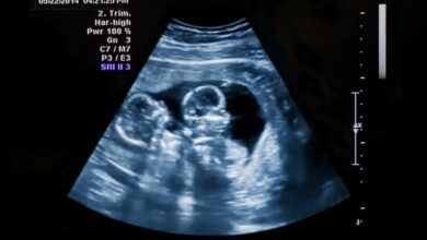 ฝันว่าท้อง เลขเด็ด