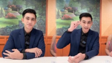โดโด้ ยุทธพิชัย หน้าใหม่ ศัลยกรรม