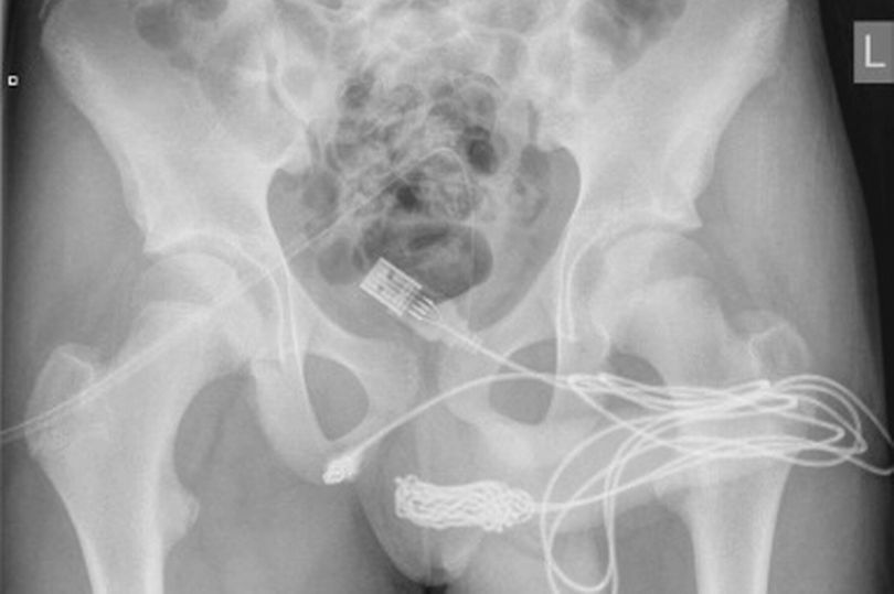 สาย USB ในอวัยวะเพศ