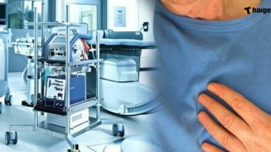 เครื่อง ECMO คือ
