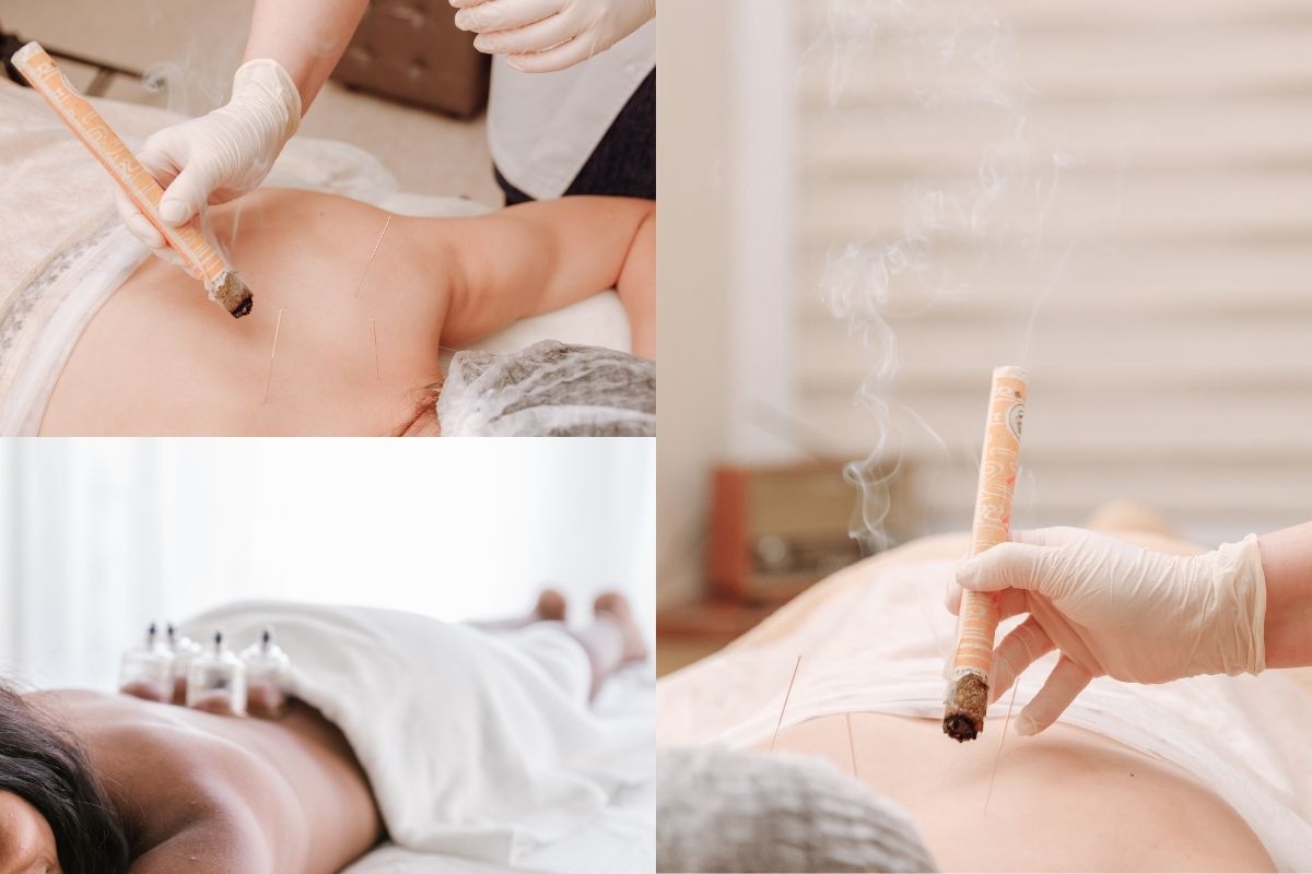 ครอบแก้ว ฝังเข็ม ที่ไหนดี แพทย์แผนจีน