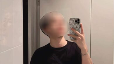 เต้ย mystyle เสียชีวิต