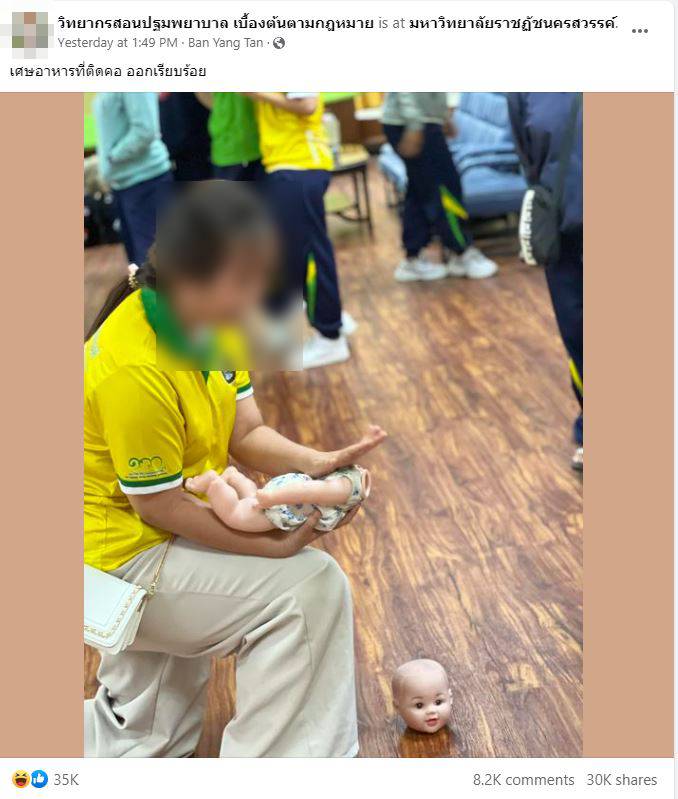 ปฐมพยาบาลอาหารติดคอเด็ก