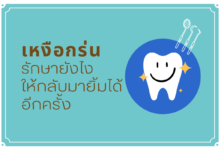 เหงือกร่น รักษา