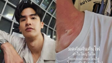 เต ตะวัน ถูกมดกัด