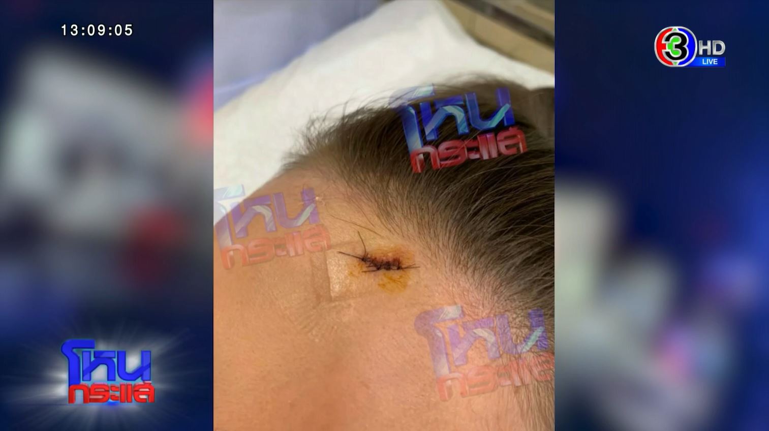 ข่าวดิว โหนกระแส