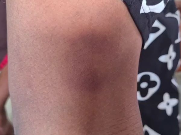 ครูนาฏศิลป์โหด ข่าว