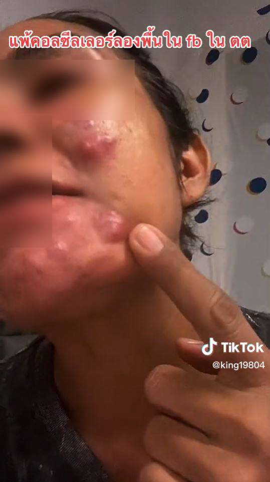 ซื้อครีมไร้มาตรฐาน