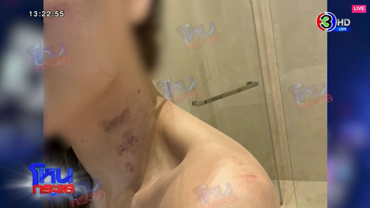 ภาพดิวถูกทำร้าย โหนกระแส