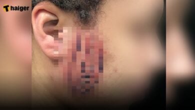 สักรูปจิ๋ม