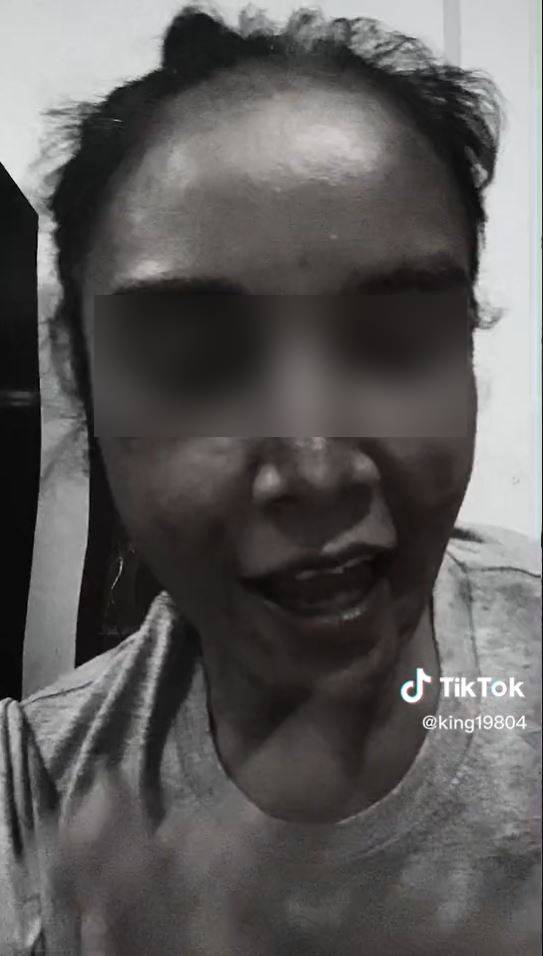 แพ้เครื่องสำอางค์