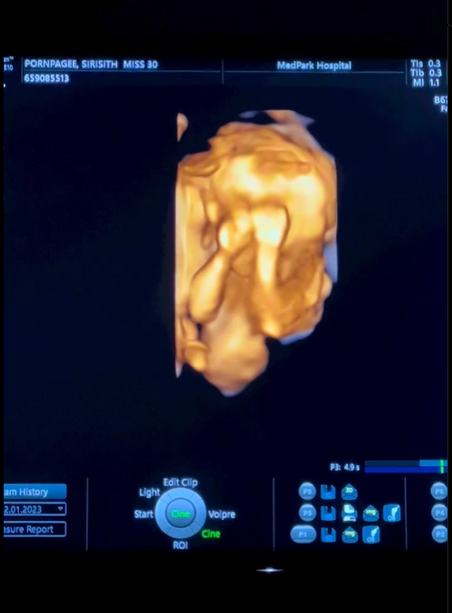 ใบเตย พรพจี