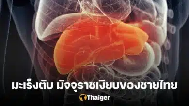 มะเร็งตับ อาการ