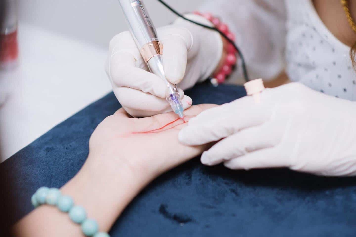 สักเส้นลายมือเศรษฐี