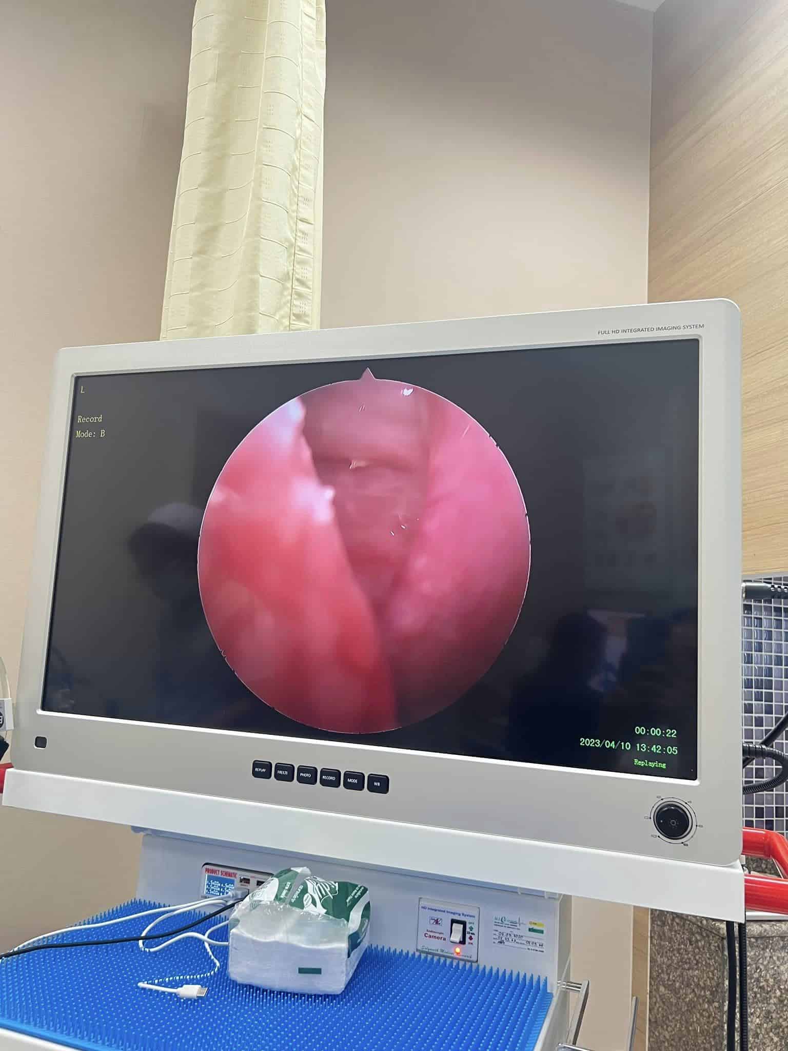 ข่าวก้างติดคอ