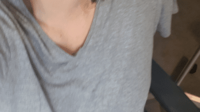 พิตบูลกัด