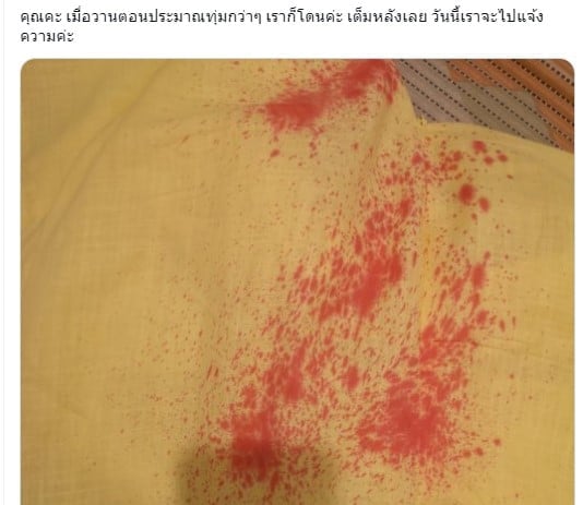 สาวเตือนภัย โดนฉีดสเปรย์สีแดงใส่กางเกง