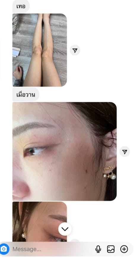 แชทของ จีจี้ สุพิชชา อิคคิว ทำร้าย