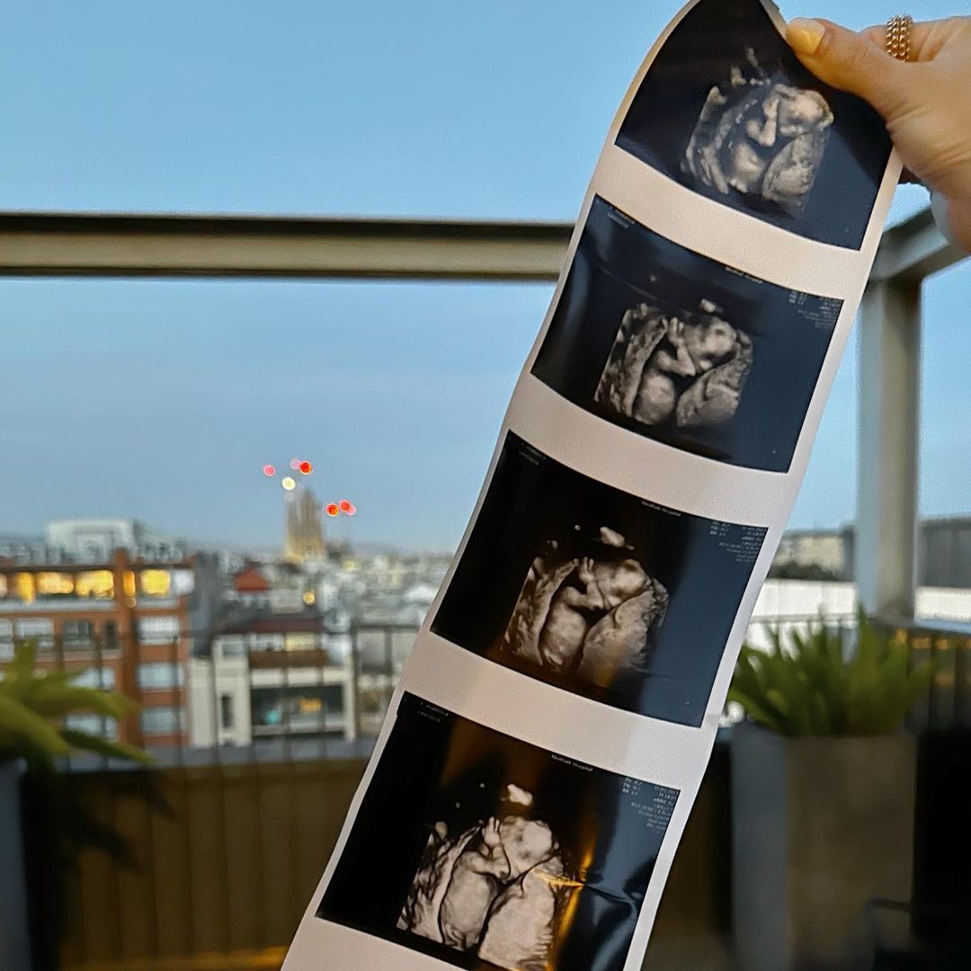 แอร์ ภัณฑิลา ตั้งท้อง