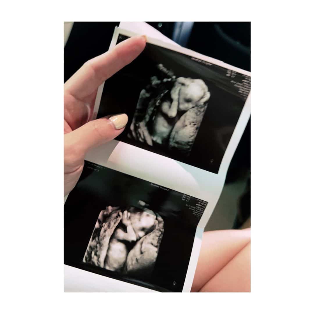 แอร์ ภัณฑิลา ตั้งท้อง