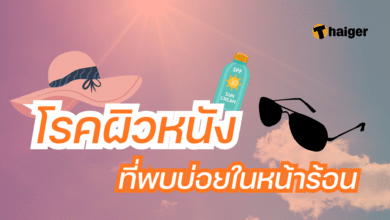 โรคผิวหนัง หน้าร้อน