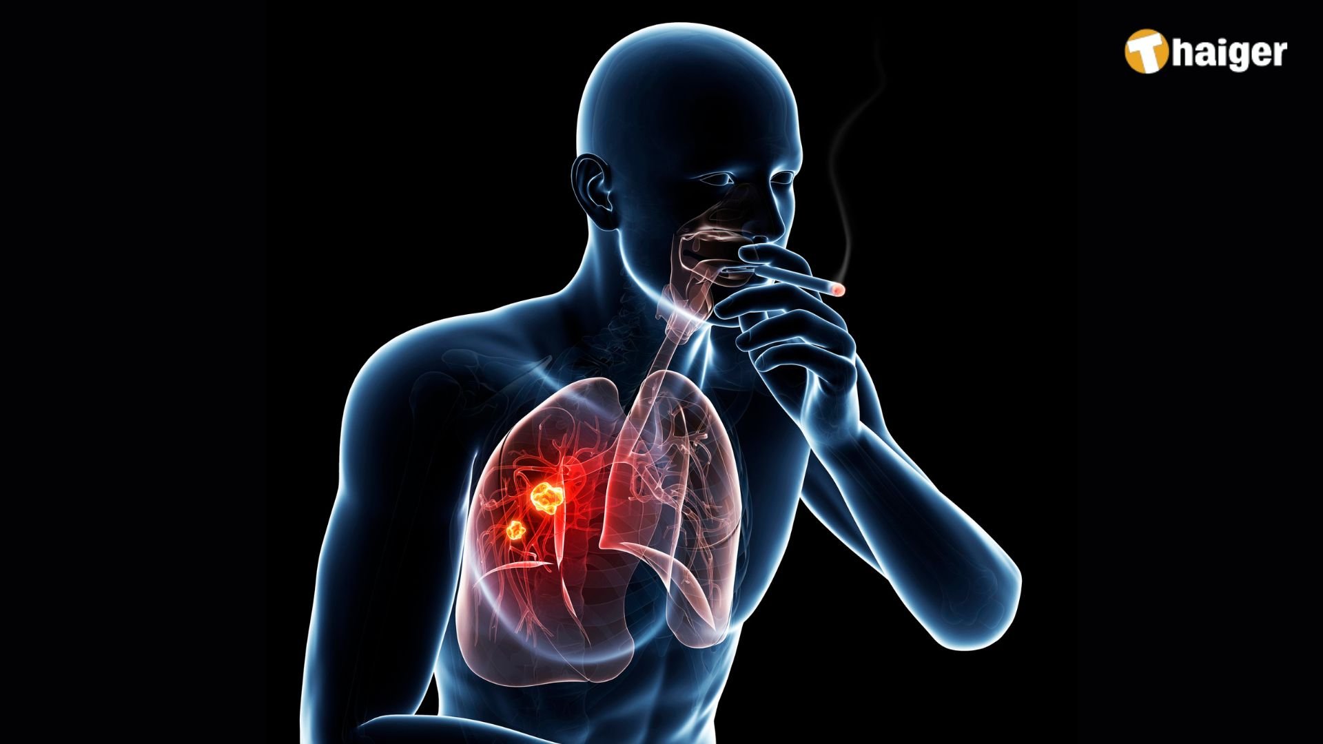 วันงดสูบบุหรี่โลก โรคร้ายที่มาพร้อมควันบุหรี่