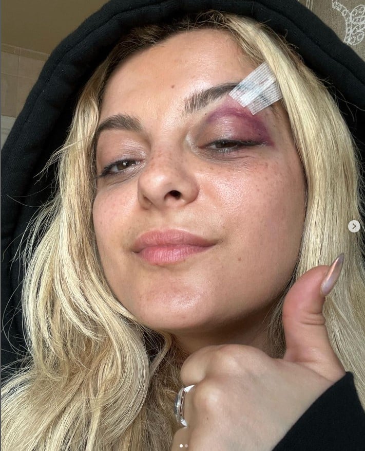 Babe Rexha ปาโทรศัพท์