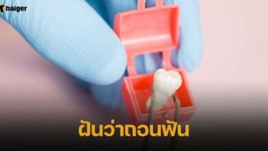รวมคำทำนาย ฝันว่าถอนฟัน