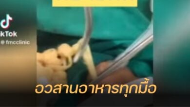 พยาธิตัวตืด