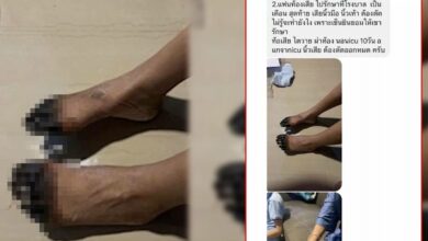 ภรรยาท้องเสีย ตัดนิ้วมือเท้าทิ้ง