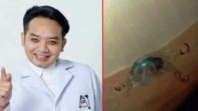 หมอแล็บ ตัวโลนดูดเลือด