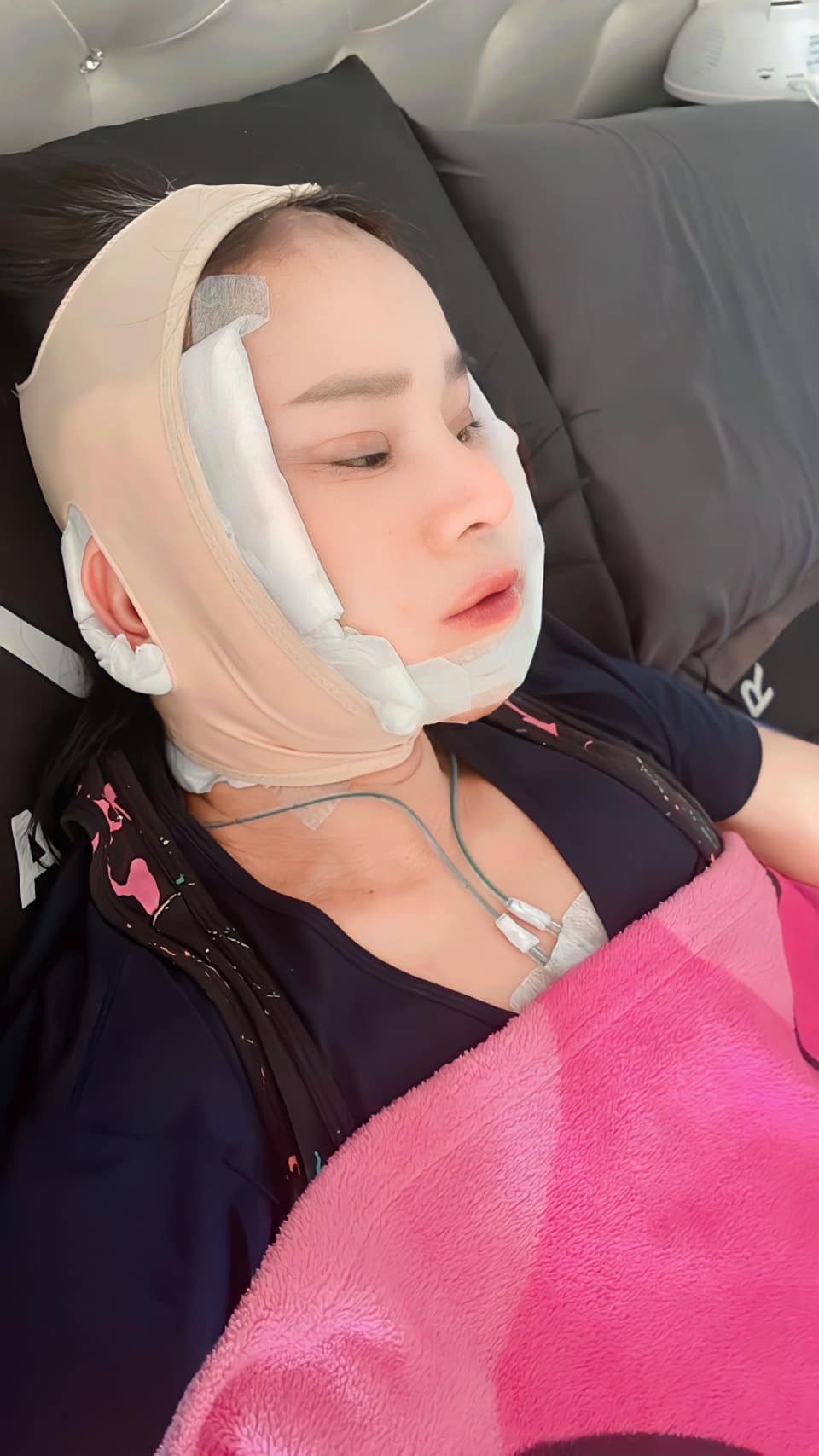 พี่พร น้องเวฟ ศัลยกรรม