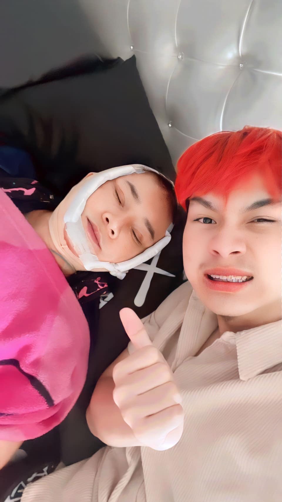 พี่พร น้องเวฟ ศัลยกรรม