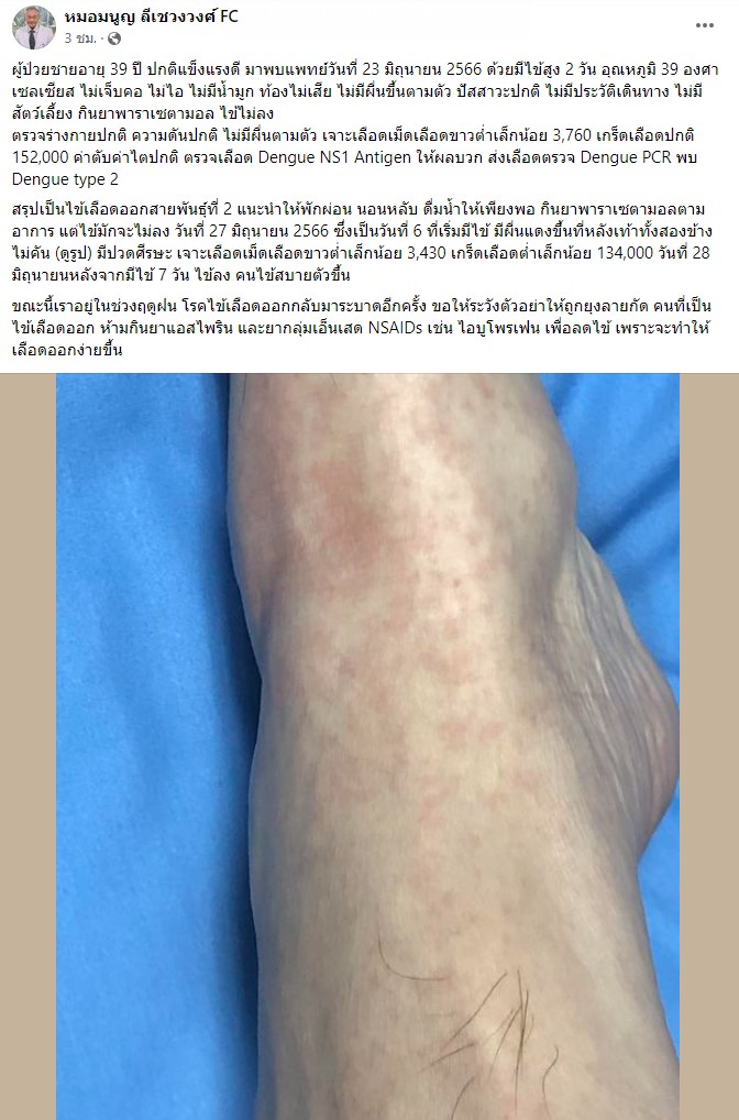 หมอมนูญ ไข้เลือดออก