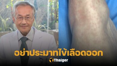 หมอมนูญ ไข้เลือดออก