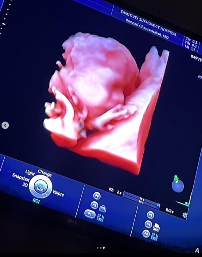 ใหญ่ ฝันดี หลานคนแรก