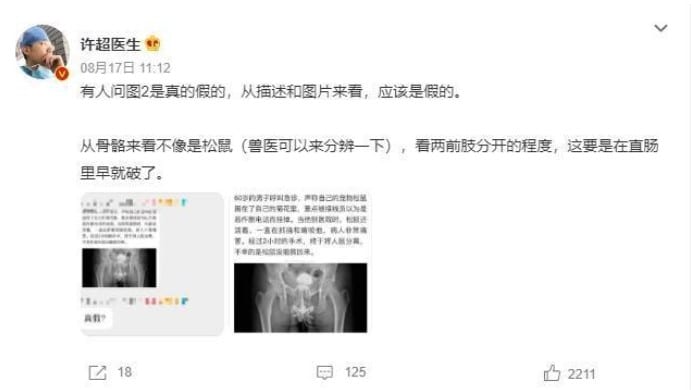 กระรอก ติดใน ทวารหนัก