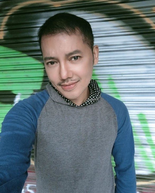 ดีเจเจ๊แหม่ม ศัลยกรรม หน้าใหม่