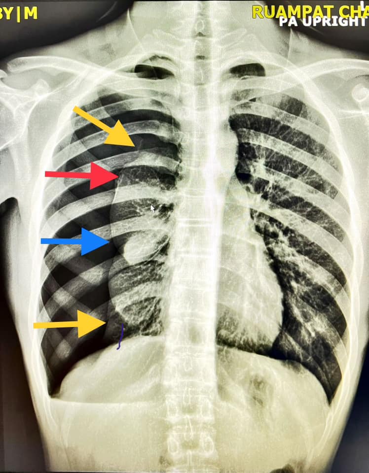 ดูข่าววันนี้