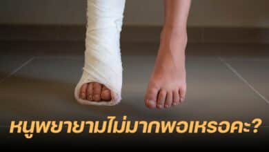 นักเรียนขาหัก