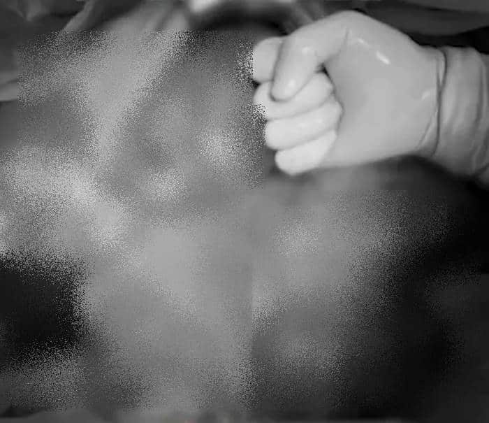 สาวจีนท้องผูก